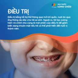 Tật không có hàm 6