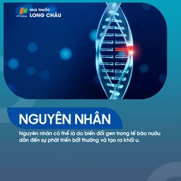 Ung thư nướu răng 3