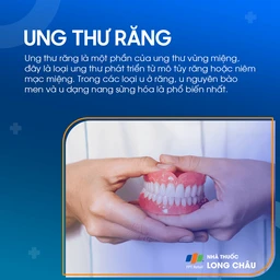 Ung thư răng 1