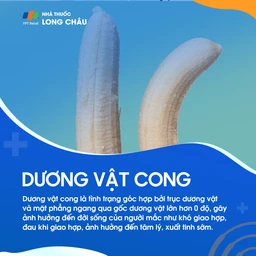 Dương vật cong 1