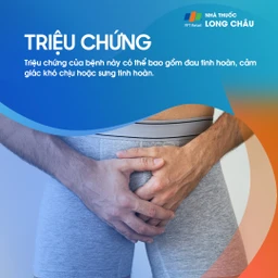 Giãn tĩnh mạch thừng tinh 2
