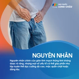 Giãn tĩnh mạch thừng tinh 3