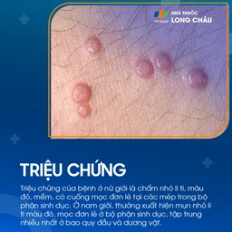 triệu chứng mụn cóc sinh dục ở người, biểu hiện qua các nốt sần hình bông cải trên da
