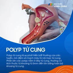 Polyp tử cung 1