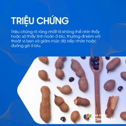 Tinh hoàn lạc chỗ 2