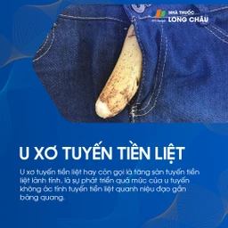U xơ tuyến tiền liệt 1