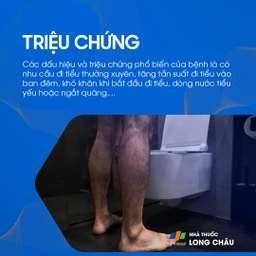 U xơ tuyến tiền liệt 2
