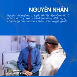 U xơ tuyến tiền liệt 3