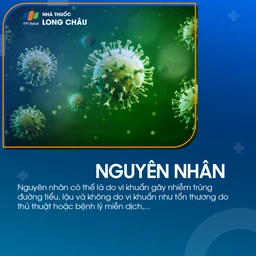 Viêm tuyến tiền liệt cấp tính 3