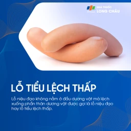 Lỗ tiểu lệch thấp 1