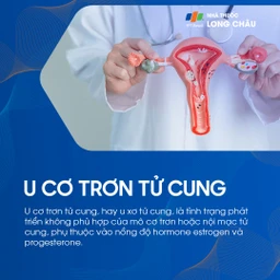 U cơ trơn tử cung 1