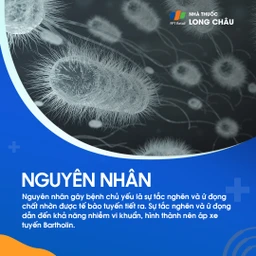 U nang tuyến Bartholin 3