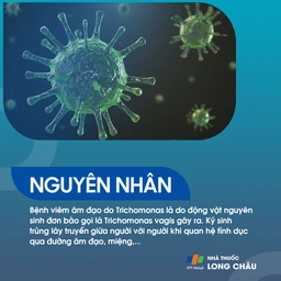 Viêm âm đạo do Trichomoniasis 3