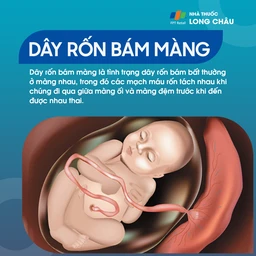 Dây rốn bám màng 1