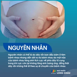 Dây rốn bám màng 3