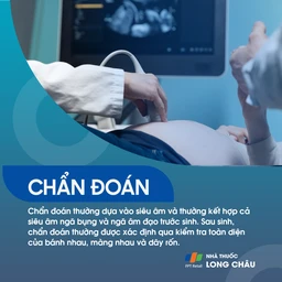 Dây rốn bám màng 5
