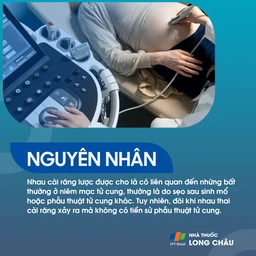 Nhau cài răng lược 3