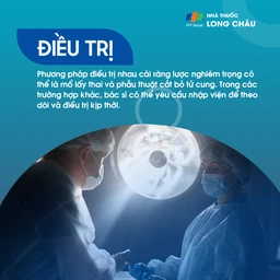 Nhau cài răng lược 6