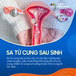 Sa tử cung sau sinh 1