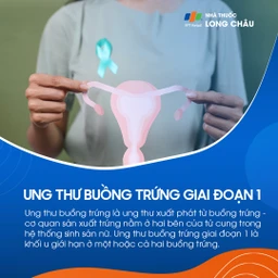 Ung thư buồng trứng giai đoạn 1 - 1