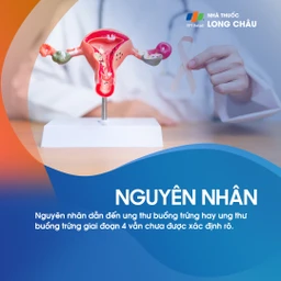 Ung thư buồng trứng giai đoạn 4 - 3