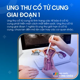 Ung thư cổ tử cung giai đoạn 1 - 1
