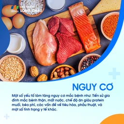 Biến chứng sỏi thận - Nguy cơ và hậu quả nghiêm trọng của bệnh sỏi thận