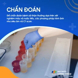 Chẩn đoán sỏi thận - Quy trình kiểm tra và xác định vị trí sỏi thận
