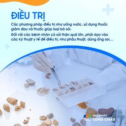Điều trị sỏi thận - Phương pháp tán sỏi và phẫu thuật loại bỏ sỏi thận