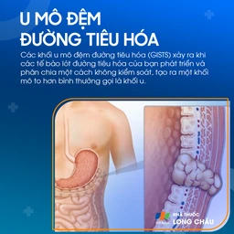 U mô đệm tiêu hóa 1