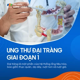 Ung thư đại tràng giai đoạn 1