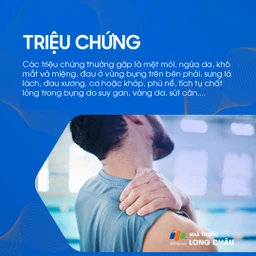 Viêm đường mật nguyên phát 2