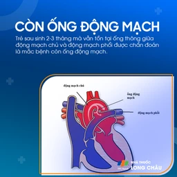 Còn ống động mạch 2