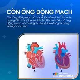 Còn ống động mạch 1
