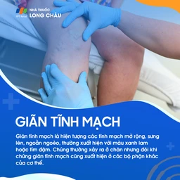 Giãn tĩnh mạch 1