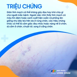 Giãn tĩnh mạch 2