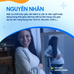 Giãn tĩnh mạch 4