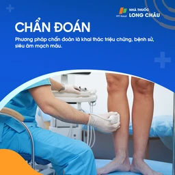 Giãn tĩnh mạch 6