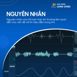 Nguyên nhân rối loạn nhịp tim do bệnh tim mạch, stress và rối loạn điện giải