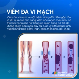 Viêm đa vi mạch 1