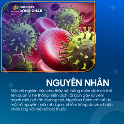 Viêm đa vi mạch 3