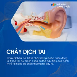 Chảy dịch tai có thể do ráy tai, nước đọng, hoặc là dấu hiệu bệnh lý – chấn thương tai