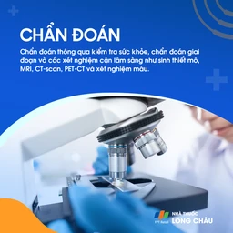 Ung thư vòm họng giai đoạn 1 - 6