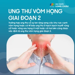 Ung thư vòm họng giai đoạn 2 - 2