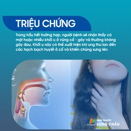 Ung thư vòm họng giai đoạn 2 -3