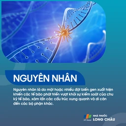 Ung thư vòm họng giai đoạn 2 - 4