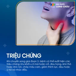 Ung thư vòm họng giai đoạn 3 - 2