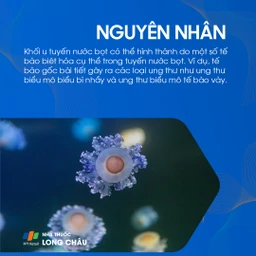 U tuyến nước bọt mang tai 4