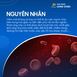 Viêm mũi mãn tính 4
