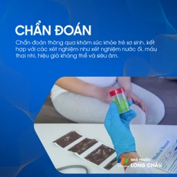 Nhiễm Toxoplasmosis bẩm sinh 5